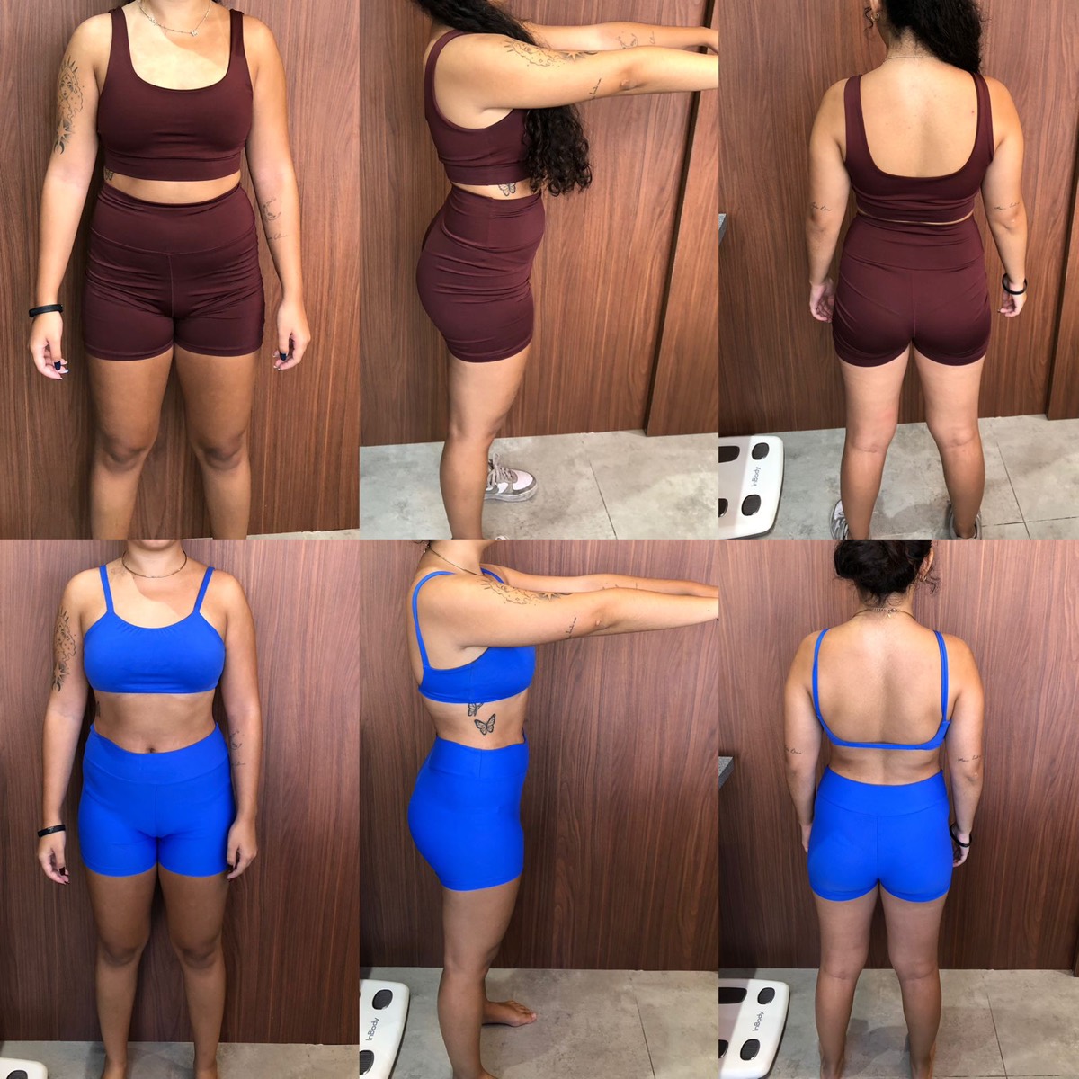 Transformação de paciente da Clínica Energia Vital — antes e depois do acompanhamento nutricional