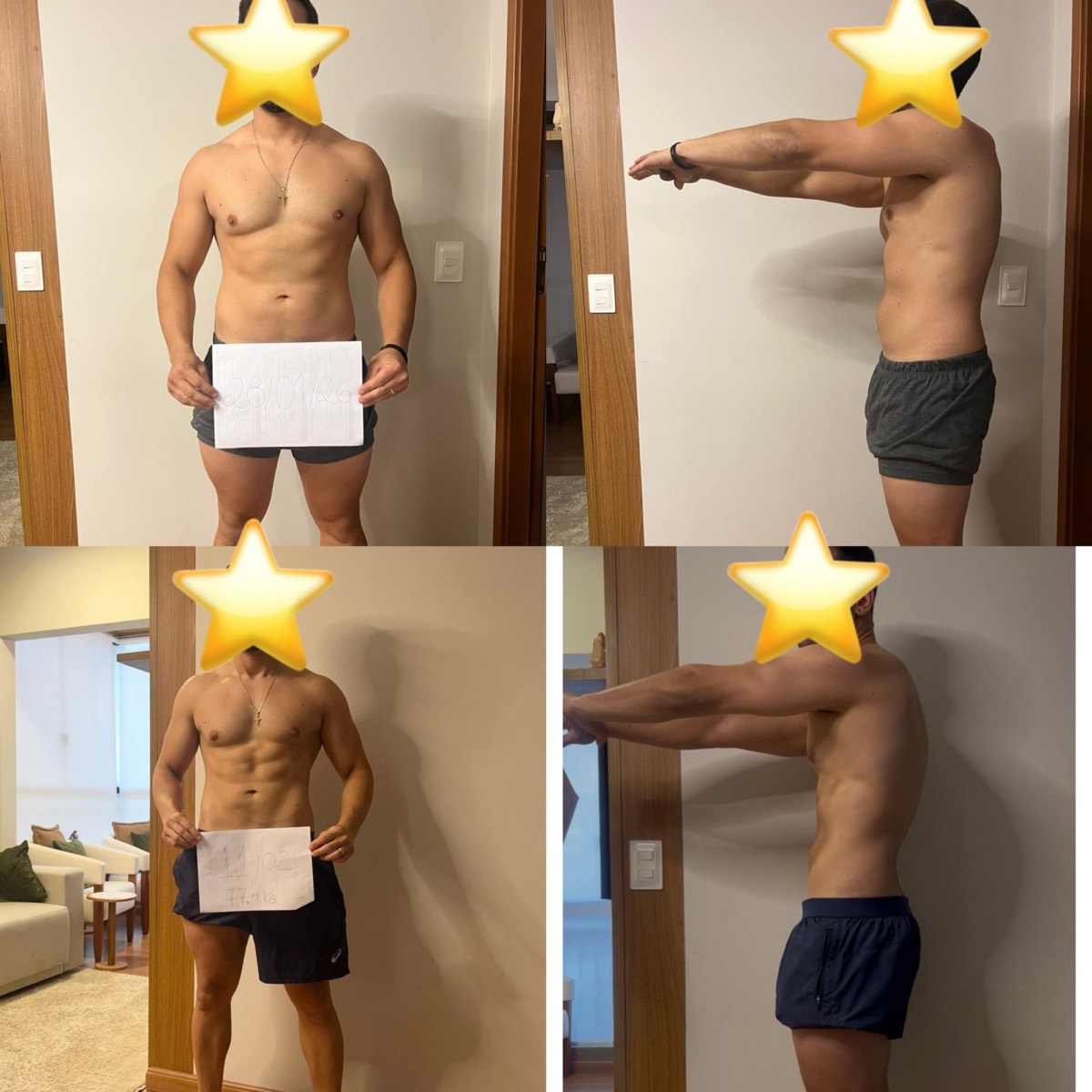 Transformação de paciente da Clínica Energia Vital — antes e depois do acompanhamento nutricional