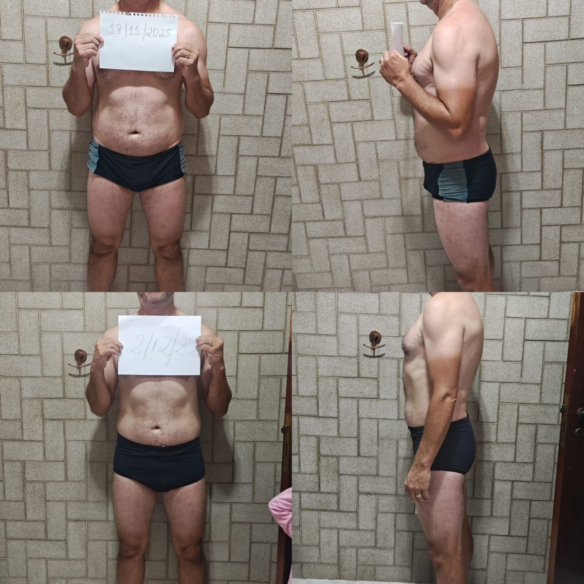 Transformação de paciente da Clínica Energia Vital — antes e depois do acompanhamento nutricional