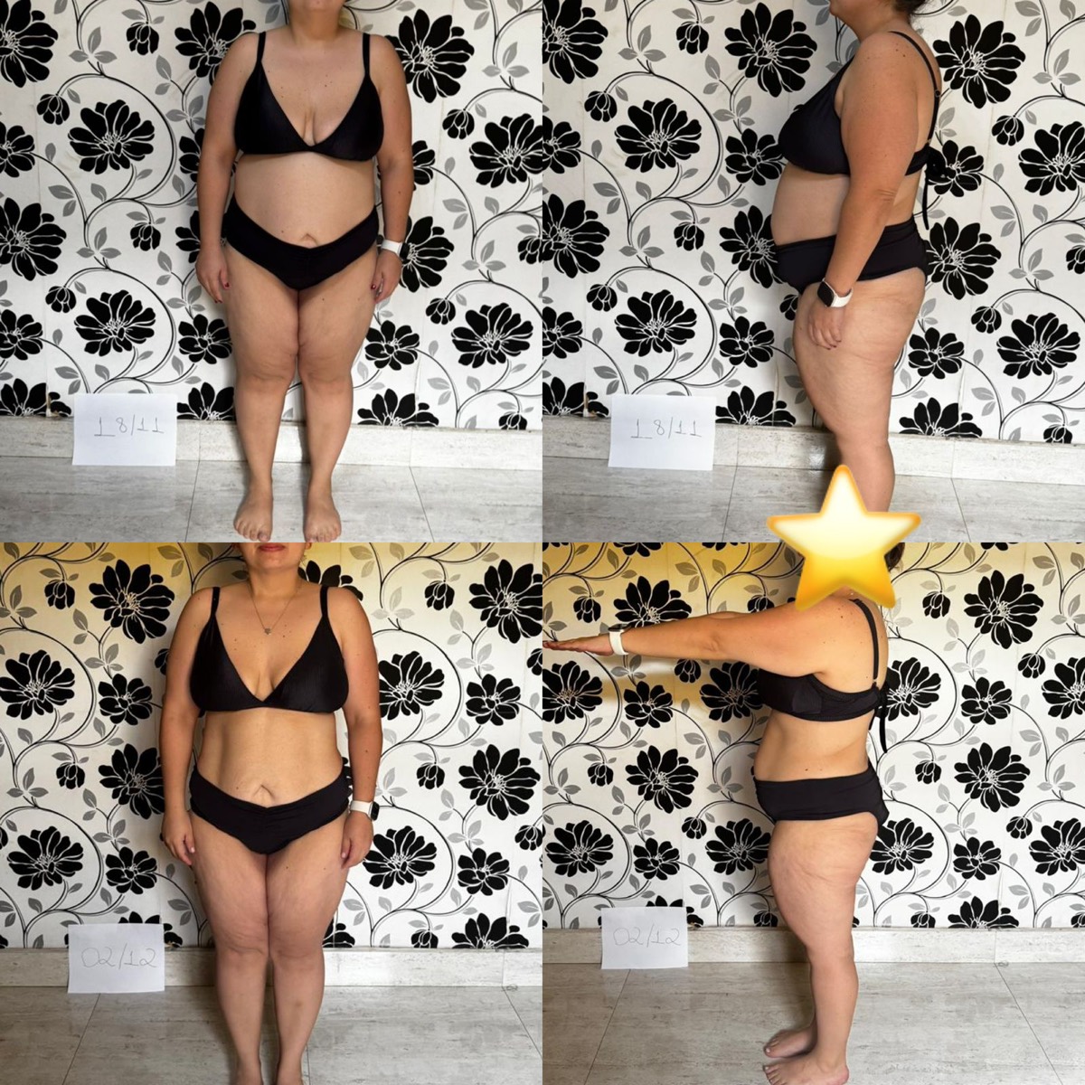 Transformação de paciente da Clínica Energia Vital — antes e depois do acompanhamento nutricional