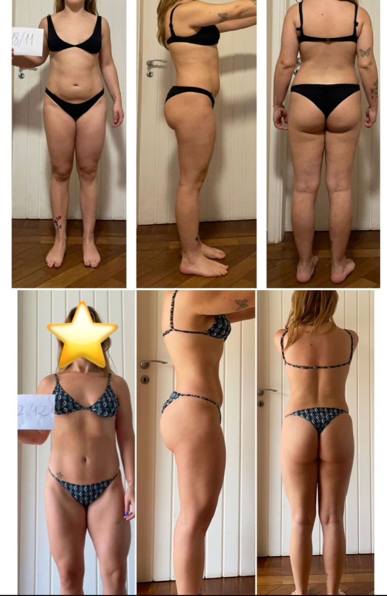 Transformação de paciente da Clínica Energia Vital — antes e depois do acompanhamento nutricional