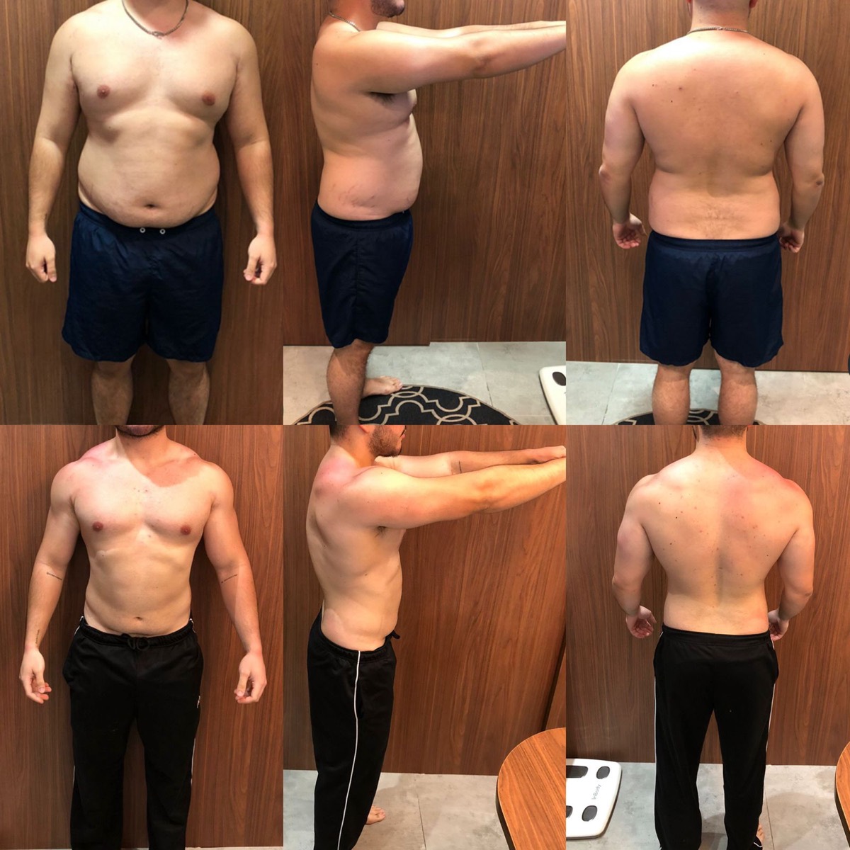 Transformação de paciente da Clínica Energia Vital — antes e depois do acompanhamento nutricional