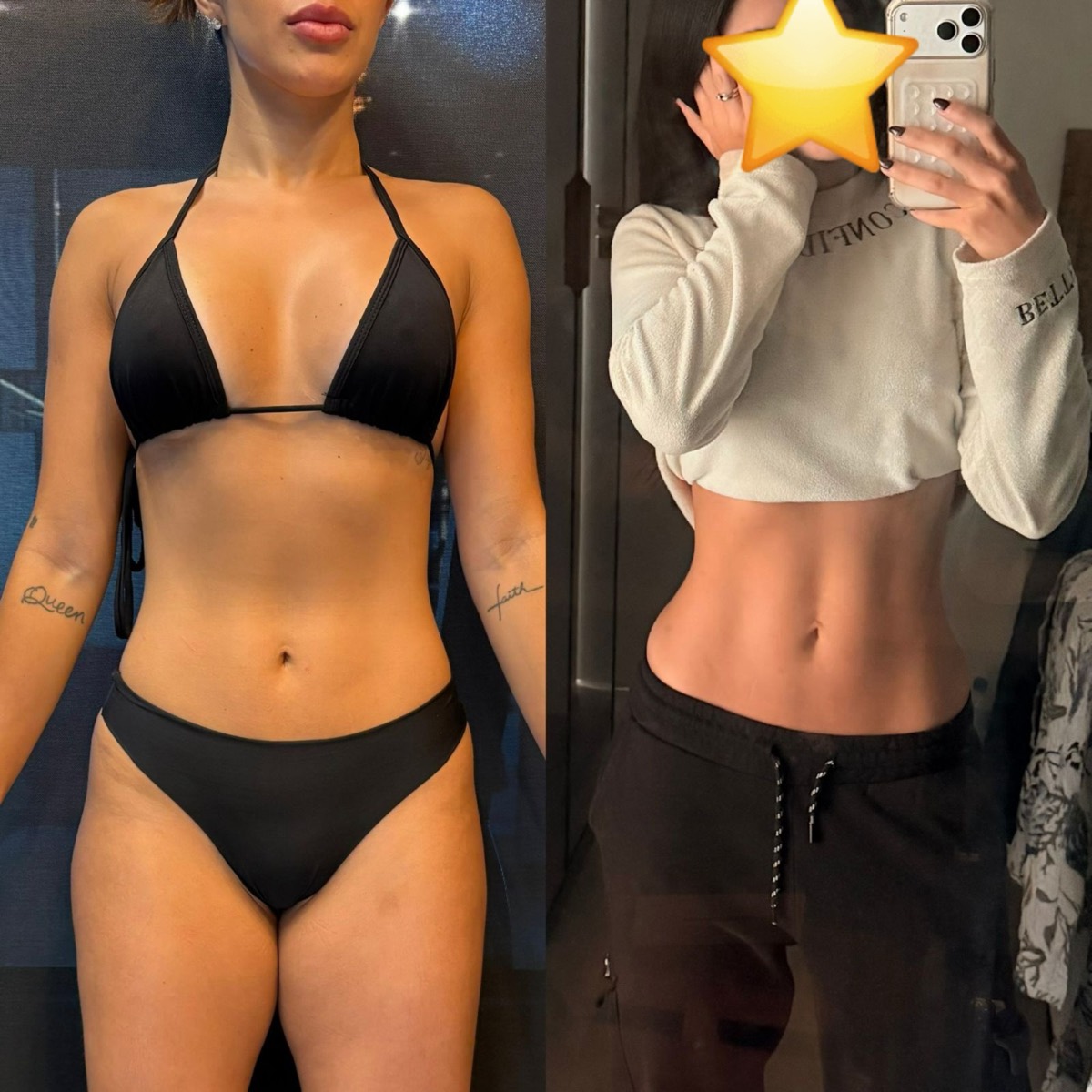 Transformação de paciente da Clínica Energia Vital — antes e depois do acompanhamento nutricional