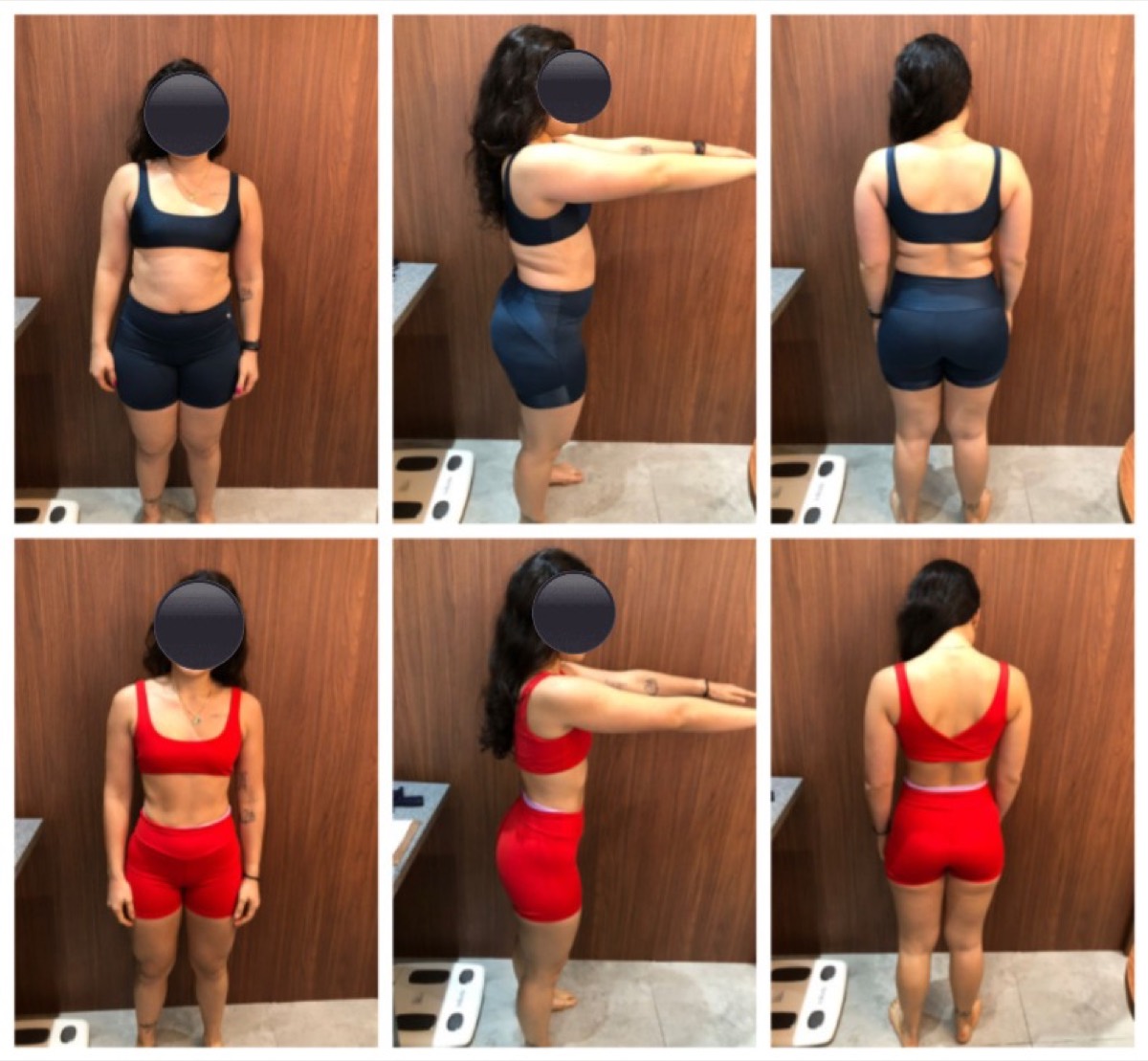 Transformação de paciente da Clínica Energia Vital — antes e depois do acompanhamento nutricional