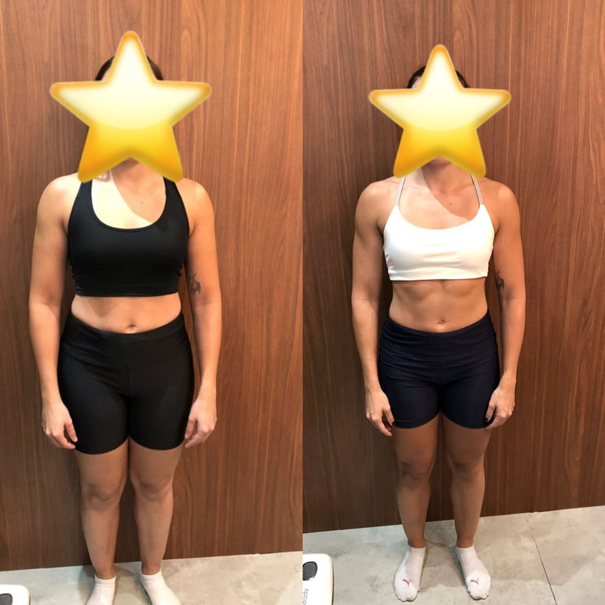 Transformação de paciente da Clínica Energia Vital — antes e depois do acompanhamento nutricional